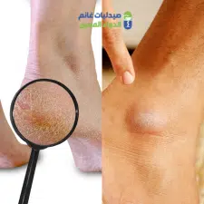 صيدليات غانم للتركيبات الصيدلانية