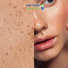 صيدليات غانم للتركيبات الصيدلانية