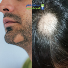 صيدليات غانم للتركيبات الصيدلانية