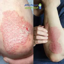 صيدليات غانم للتركيبات الصيدلانية