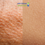 تركيبه جلد الوزه