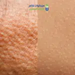 تركيبه جلد الوزه