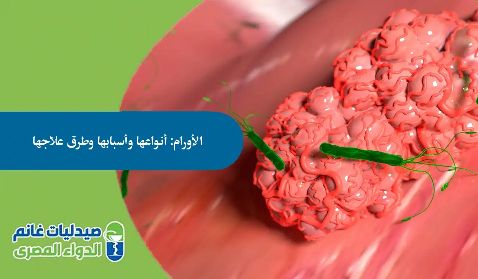 الأورام: أنواعها وأسبابها وطرق علاجها - الدواء المصري