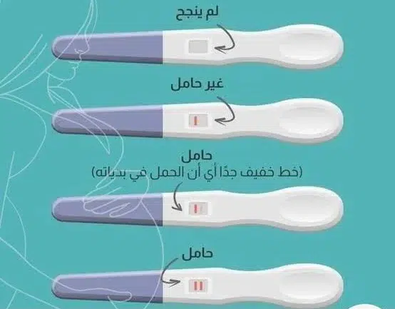 ماذا يعني حرف T و C في اختبار الحمل؟