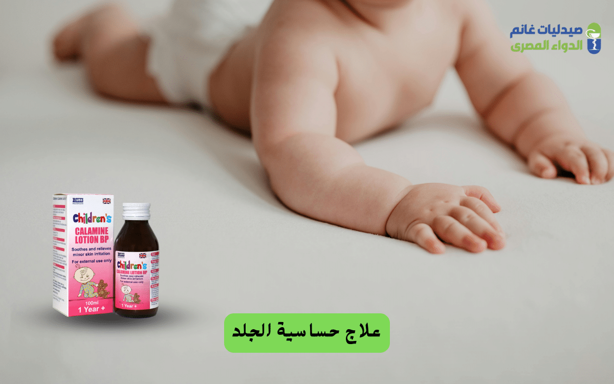 أفضل الكريمات الآمنة في علاج حساسية الجلد للأطفال