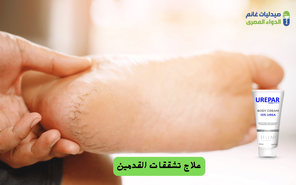 ​أفضل كريم تشقق القدمين في الصيدليات (فئة اليوريا)
