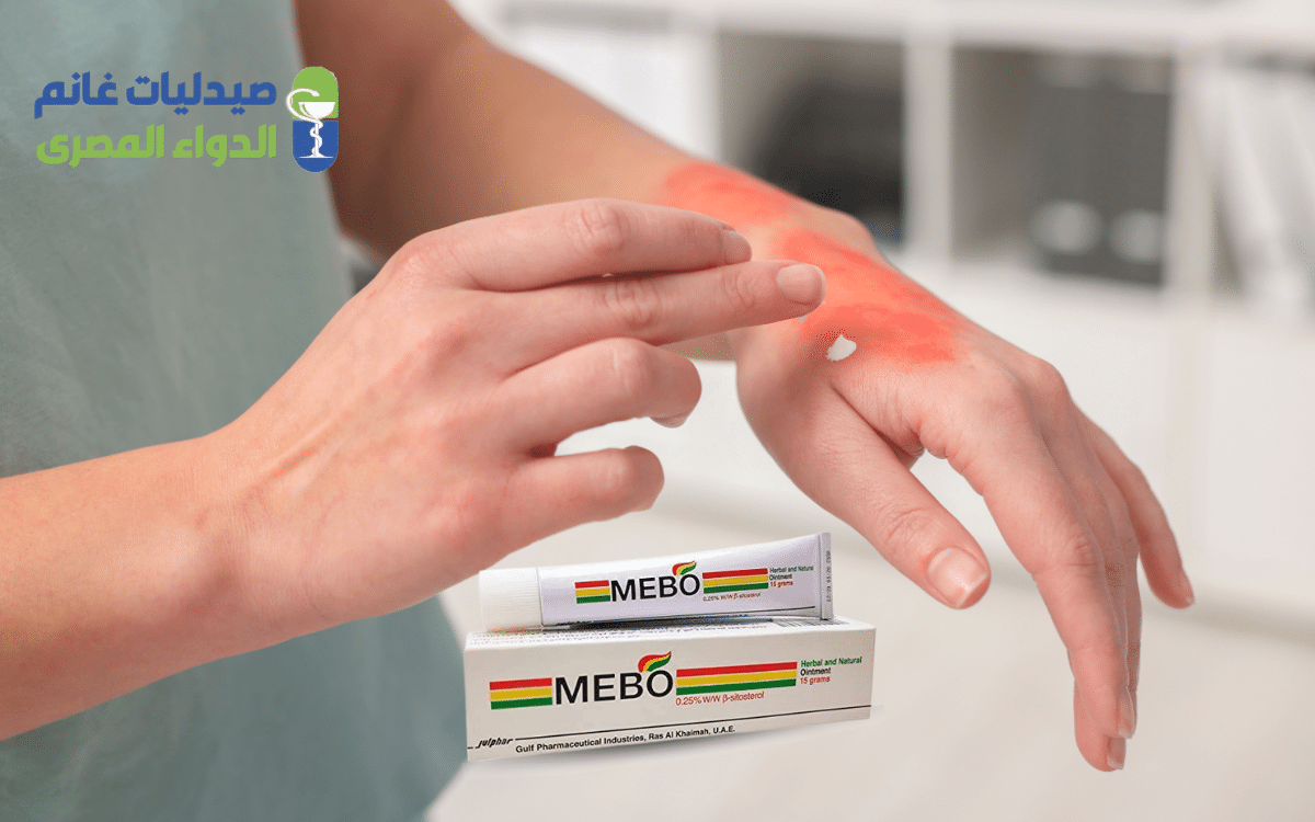 ​دواعي استعمال كريم ميبو للحروق والجروح
