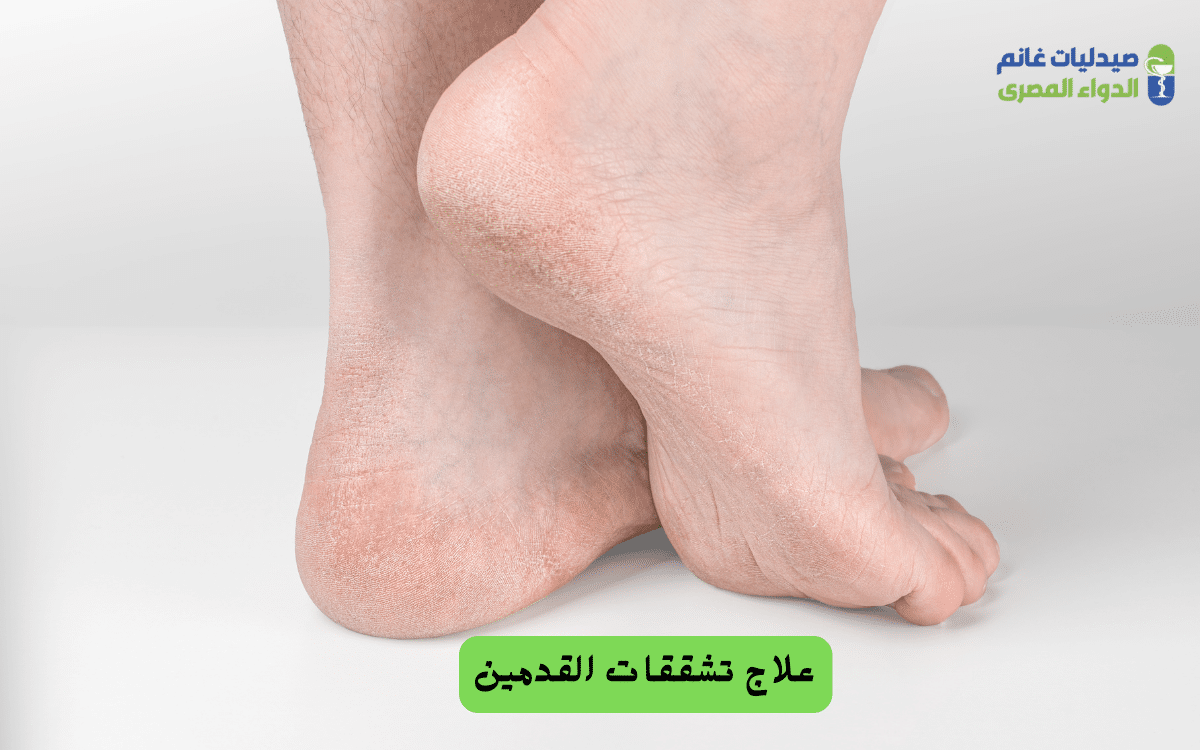 ​دور التغذية والفيتامينات في صحة جلد القدمين