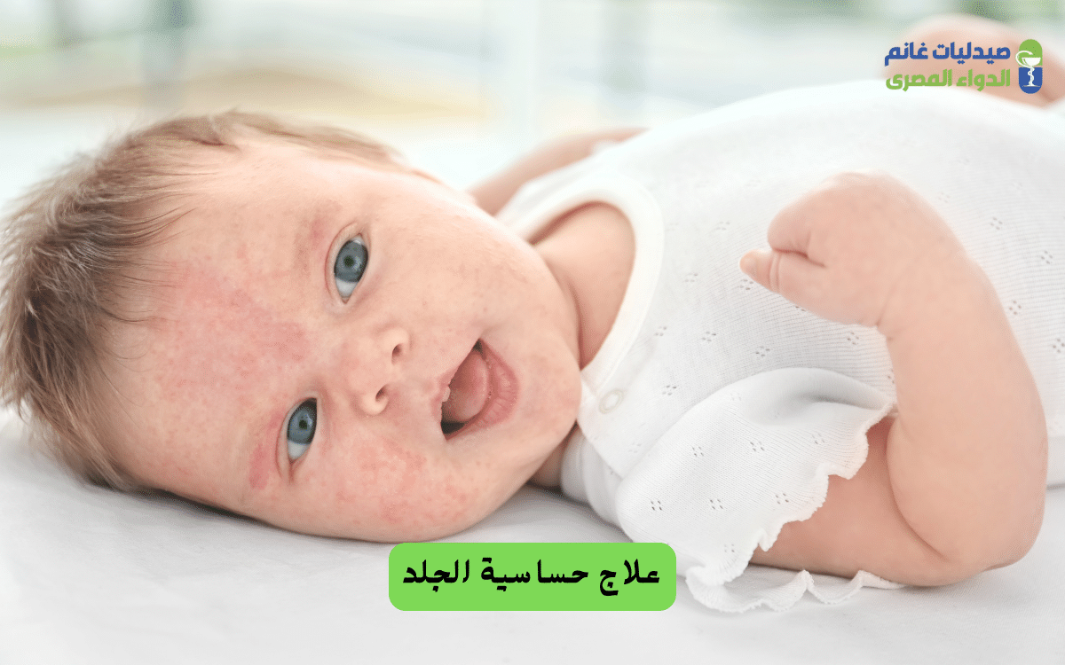علاج حساسية الجلد