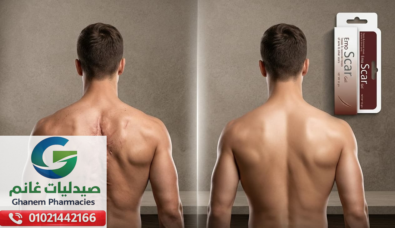 ايمو سكار كريم 60 جم