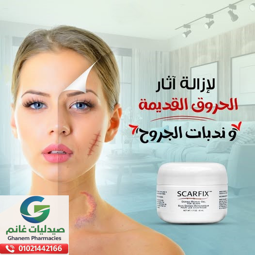 سكار فيكس جل 45 مل