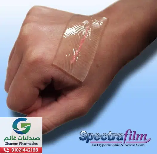 اسبكترا فيلم 12*14.5 سم شيت