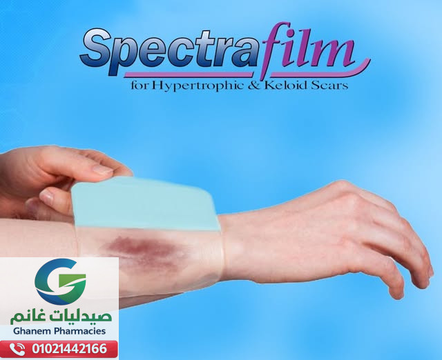 اسبكترا فيلم 12*14.5 سم شيت