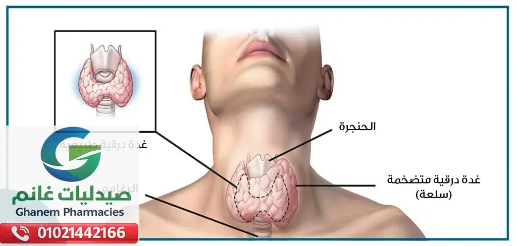 بدائل التروكسين في مصر | افضل ادوية لعلاج خمول الغدة الدرقية|اسعار التروكسين المستورد