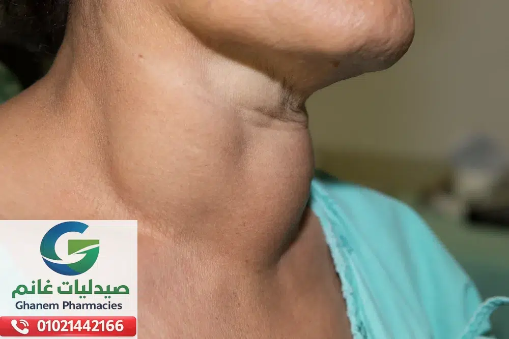 بدائل التروكسين في مصر | افضل ادوية لعلاج خمول الغدة الدرقية|اسعار التروكسين المستورد