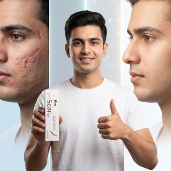 ايمو سكار كريم 30 جم