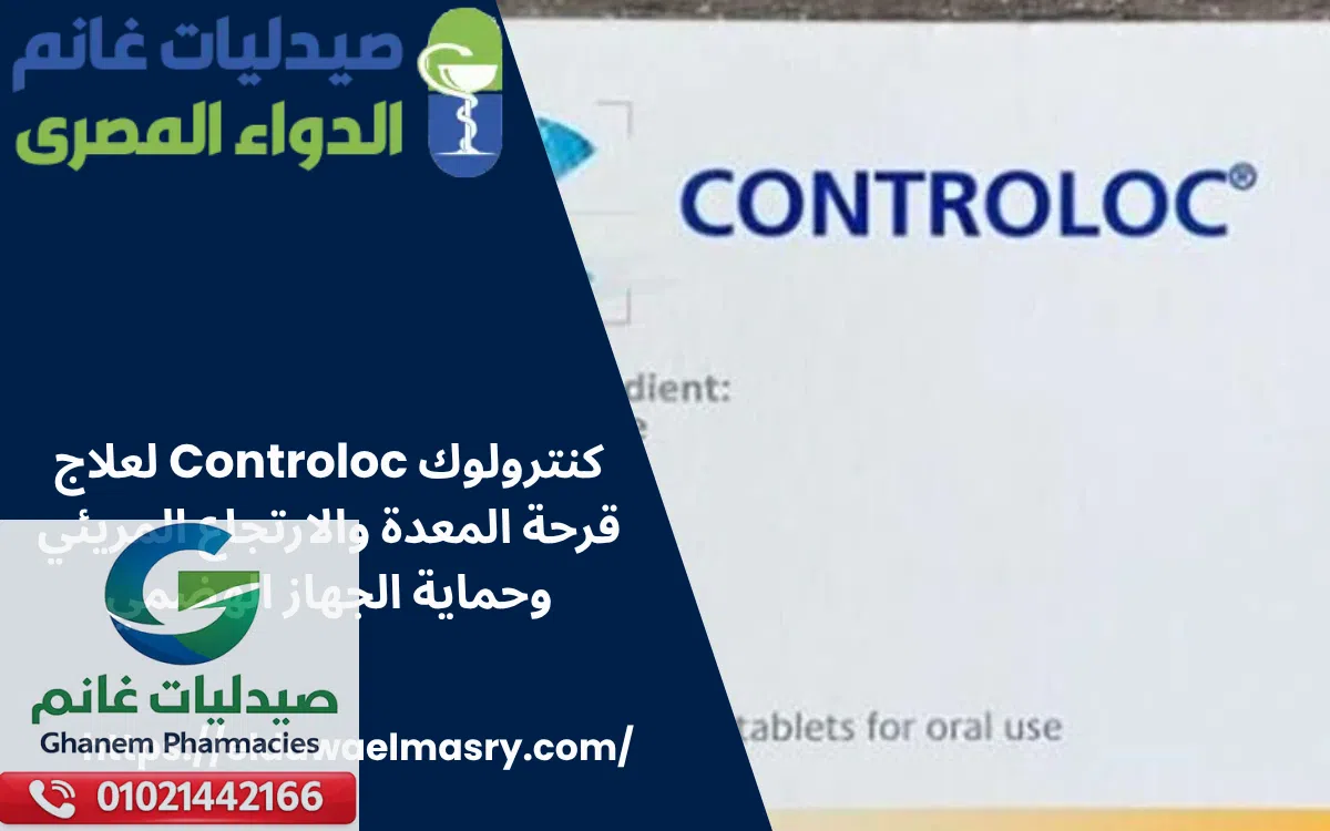 كنترولوك Controloc